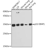 Western Blot - Anti-TP53INP1 Antibody [ARC2102] (A308214) - Antibodies.com
