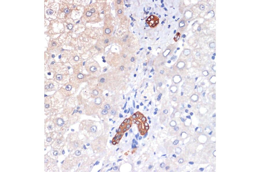 Immunohistochemistry - Anti-TP53INP1 Antibody [ARC2102] (A308214) - Antibodies.com