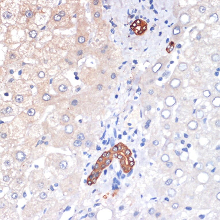 Immunohistochemistry - Anti-TP53INP1 Antibody [ARC2102] (A308214) - Antibodies.com