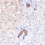 Immunohistochemistry - Anti-TP53INP1 Antibody [ARC2102] (A308214) - Antibodies.com