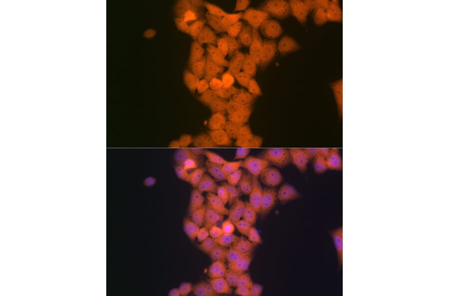 Immunofluorescence - Anti-TP53INP1 Antibody [ARC2102] (A308214) - Antibodies.com