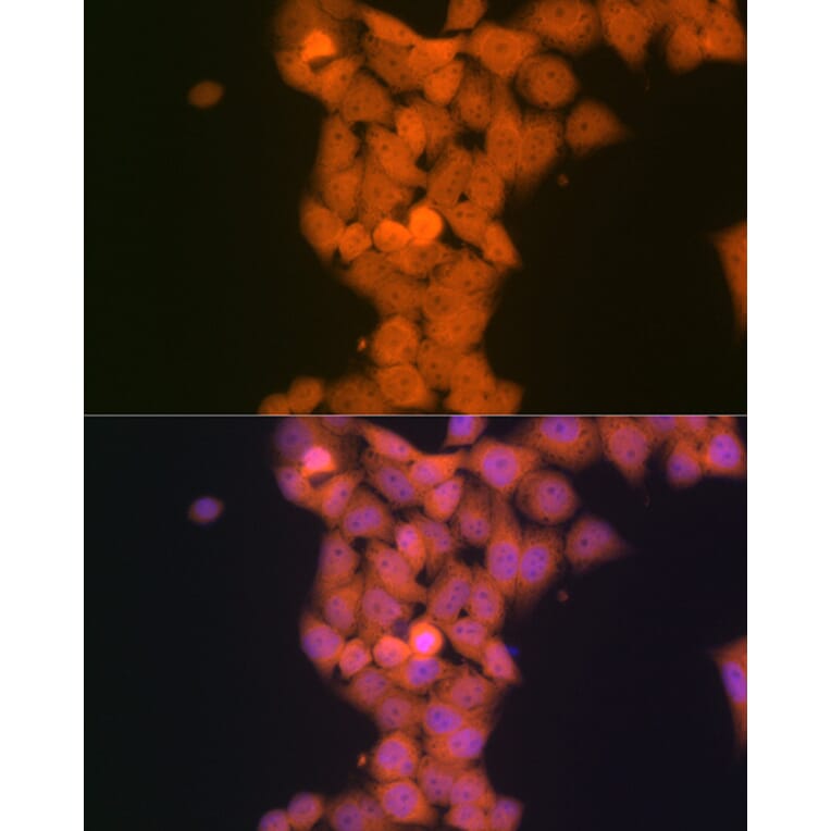 Immunofluorescence - Anti-TP53INP1 Antibody [ARC2102] (A308214) - Antibodies.com