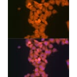 Immunofluorescence - Anti-TP53INP1 Antibody [ARC2102] (A308214) - Antibodies.com