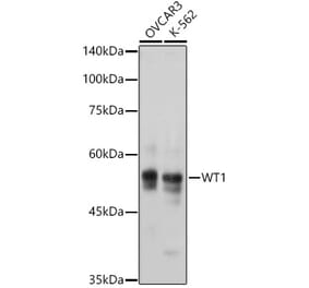 Western Blot - Anti-Wilms Tumor Protein Antibody [ARC2610] (A308215) - Antibodies.com
