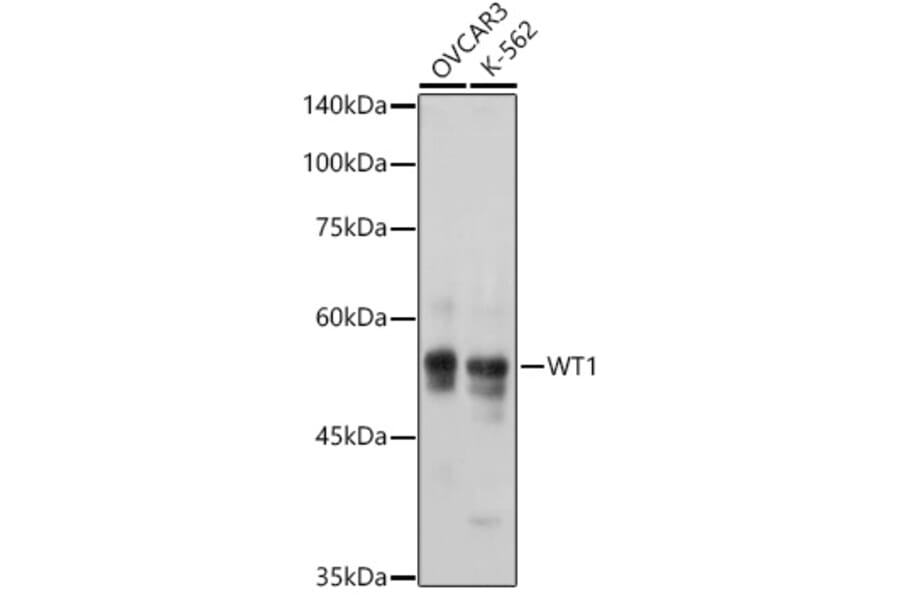 Western Blot - Anti-Wilms Tumor Protein Antibody [ARC2610] (A308215) - Antibodies.com