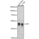 Western Blot - Anti-Wilms Tumor Protein Antibody [ARC2610] (A308215) - Antibodies.com