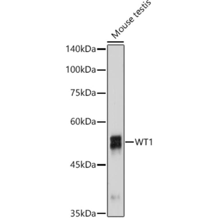Western Blot - Anti-Wilms Tumor Protein Antibody [ARC2610] (A308215) - Antibodies.com
