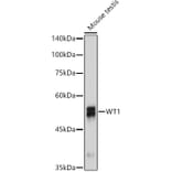 Western Blot - Anti-Wilms Tumor Protein Antibody [ARC2610] (A308215) - Antibodies.com