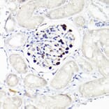 Immunohistochemistry - Anti-Wilms Tumor Protein Antibody [ARC2610] (A308215) - Antibodies.com