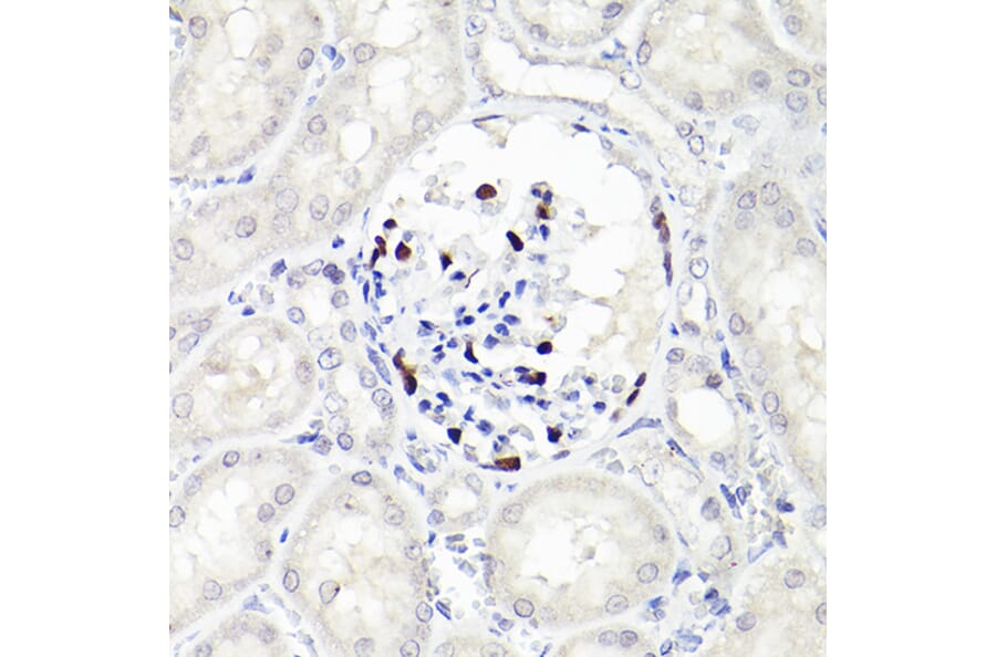 Immunohistochemistry - Anti-Wilms Tumor Protein Antibody [ARC2610] (A308215) - Antibodies.com