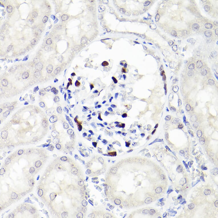 Immunohistochemistry - Anti-Wilms Tumor Protein Antibody [ARC2610] (A308215) - Antibodies.com