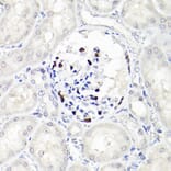 Immunohistochemistry - Anti-Wilms Tumor Protein Antibody [ARC2610] (A308215) - Antibodies.com