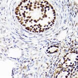 Immunohistochemistry - Anti-Wilms Tumor Protein Antibody [ARC2610] (A308215) - Antibodies.com