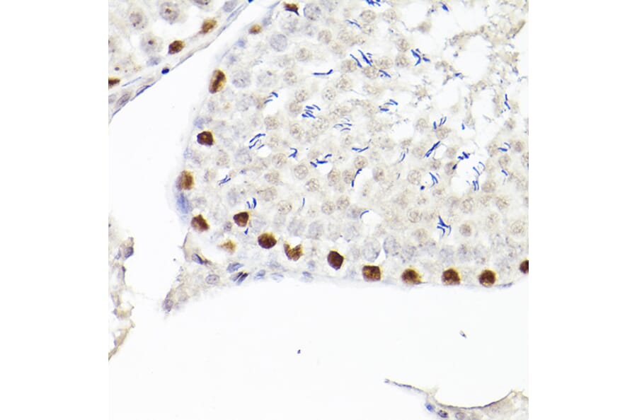 Immunohistochemistry - Anti-Wilms Tumor Protein Antibody [ARC2610] (A308215) - Antibodies.com