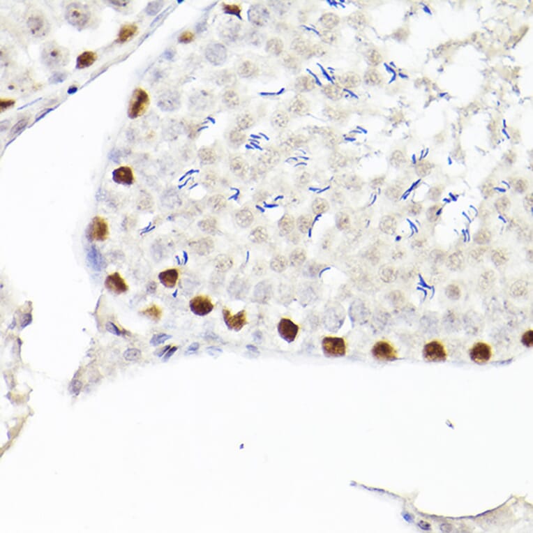Immunohistochemistry - Anti-Wilms Tumor Protein Antibody [ARC2610] (A308215) - Antibodies.com