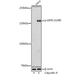 Western Blot - Anti-LRP6 (phospho Ser1490) Antibody (A308216) - Antibodies.com