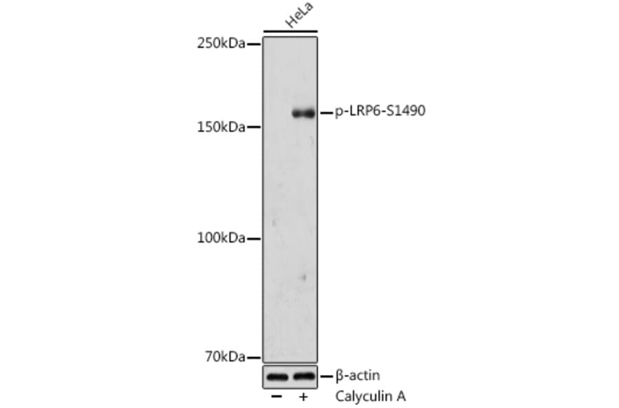 Western Blot - Anti-LRP6 (phospho Ser1490) Antibody (A308216) - Antibodies.com