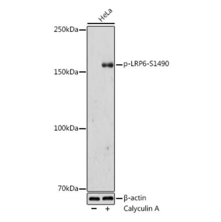 Western Blot - Anti-LRP6 (phospho Ser1490) Antibody (A308216) - Antibodies.com