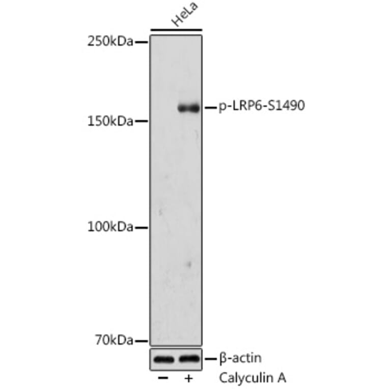 Western Blot - Anti-LRP6 (phospho Ser1490) Antibody (A308216) - Antibodies.com