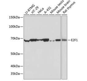 Western Blot - Anti-E2F1 Antibody [ARC0058] (A308217) - Antibodies.com
