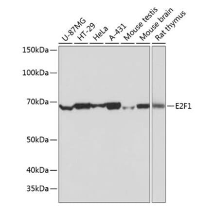 Western Blot - Anti-E2F1 Antibody [ARC0058] (A308217) - Antibodies.com