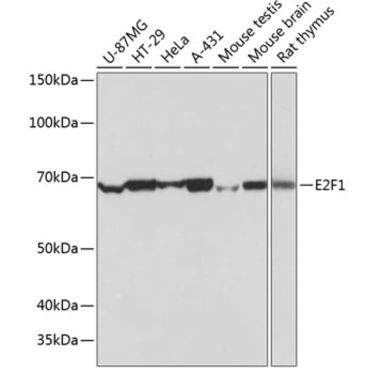 Western Blot - Anti-E2F1 Antibody [ARC0058] (A308217) - Antibodies.com