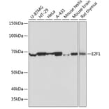 Western Blot - Anti-E2F1 Antibody [ARC0058] (A308217) - Antibodies.com