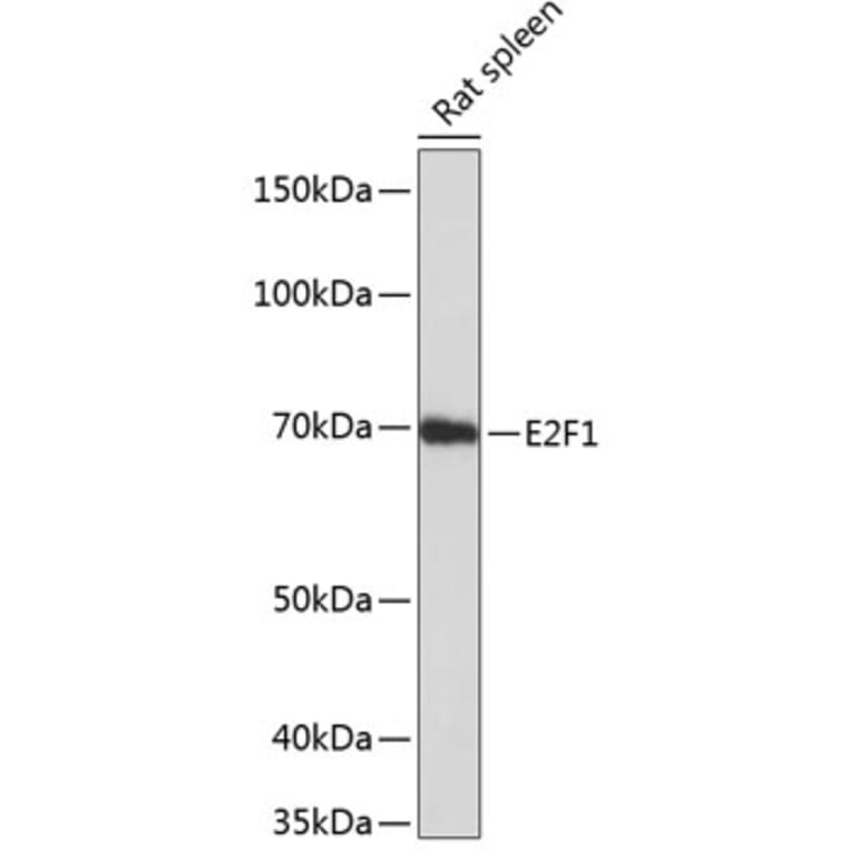 Western Blot - Anti-E2F1 Antibody [ARC0058] (A308217) - Antibodies.com