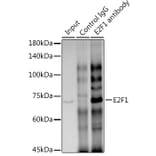 Western Blot - Anti-E2F1 Antibody [ARC0058] (A308217) - Antibodies.com