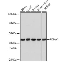 Western Blot - Anti-PDHA1 Antibody [ARC0722] (A308220) - Antibodies.com