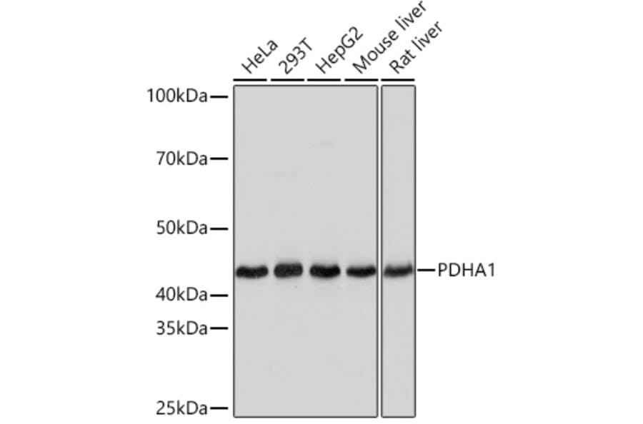 Western Blot - Anti-PDHA1 Antibody [ARC0722] (A308220) - Antibodies.com