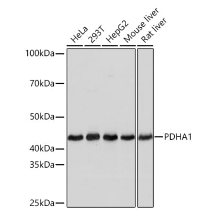 Western Blot - Anti-PDHA1 Antibody [ARC0722] (A308220) - Antibodies.com