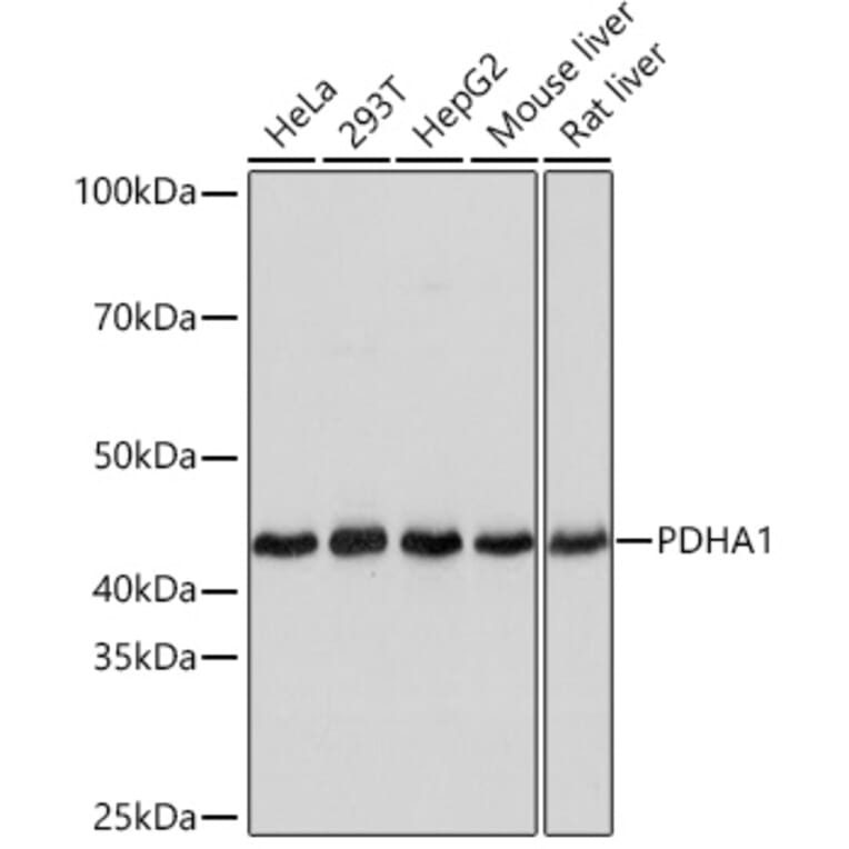Western Blot - Anti-PDHA1 Antibody [ARC0722] (A308220) - Antibodies.com