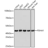 Western Blot - Anti-PDHA1 Antibody [ARC0722] (A308220) - Antibodies.com