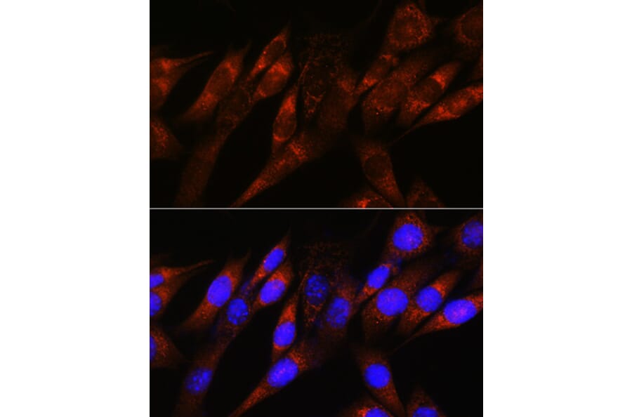 Immunofluorescence - Anti-PDHA1 Antibody [ARC0722] (A308220) - Antibodies.com