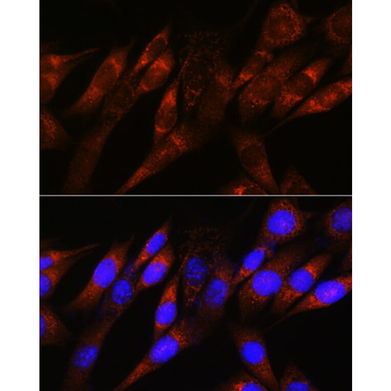 Immunofluorescence - Anti-PDHA1 Antibody [ARC0722] (A308220) - Antibodies.com