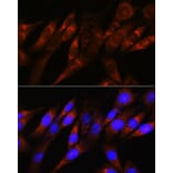 Immunofluorescence - Anti-PDHA1 Antibody [ARC0722] (A308220) - Antibodies.com