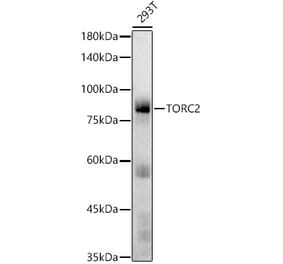Western Blot - Anti-TORC2 Antibody [ARC2851] (A308221) - Antibodies.com