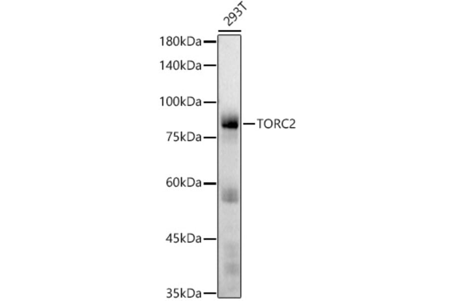 Western Blot - Anti-TORC2 Antibody [ARC2851] (A308221) - Antibodies.com