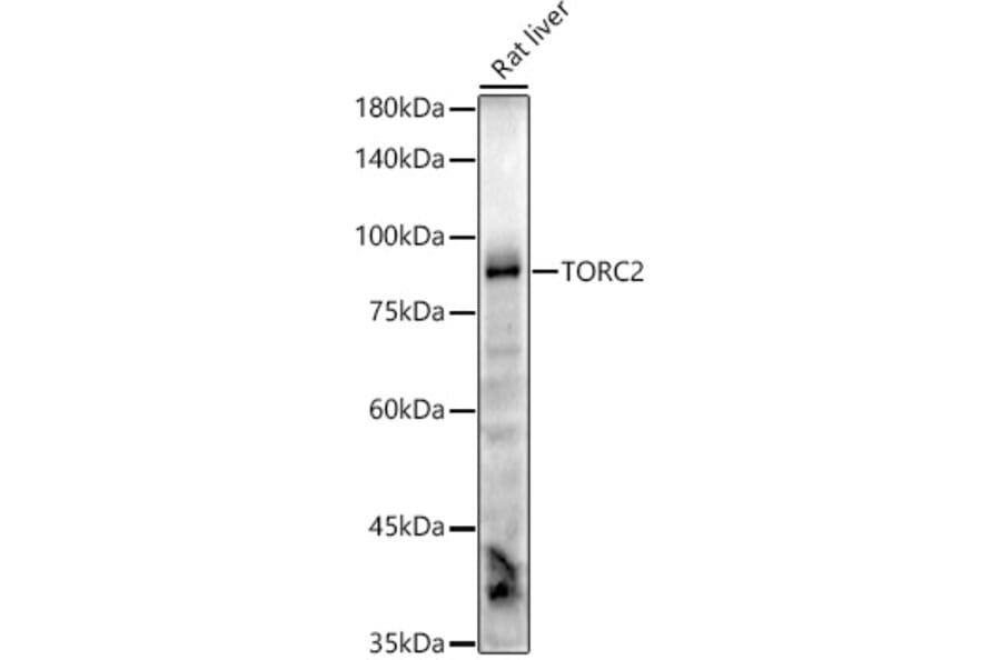 Western Blot - Anti-TORC2 Antibody [ARC2851] (A308221) - Antibodies.com