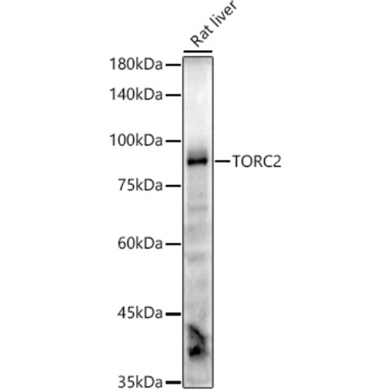 Western Blot - Anti-TORC2 Antibody [ARC2851] (A308221) - Antibodies.com
