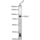 Western Blot - Anti-TORC2 Antibody [ARC2851] (A308221) - Antibodies.com