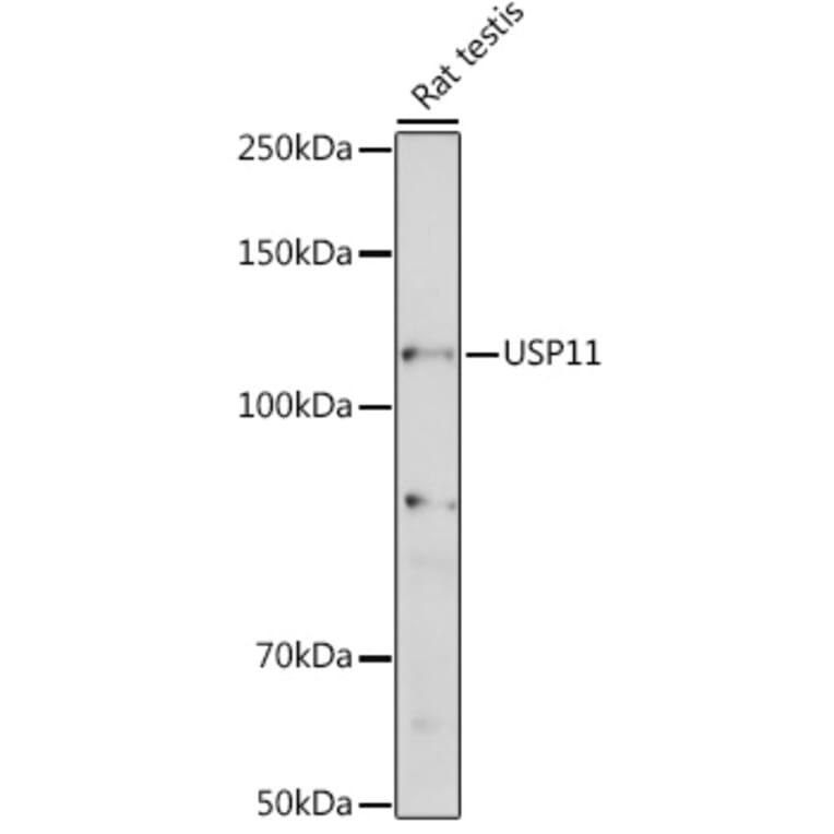 Western Blot - Anti-USP11 Antibody (A308222) - Antibodies.com