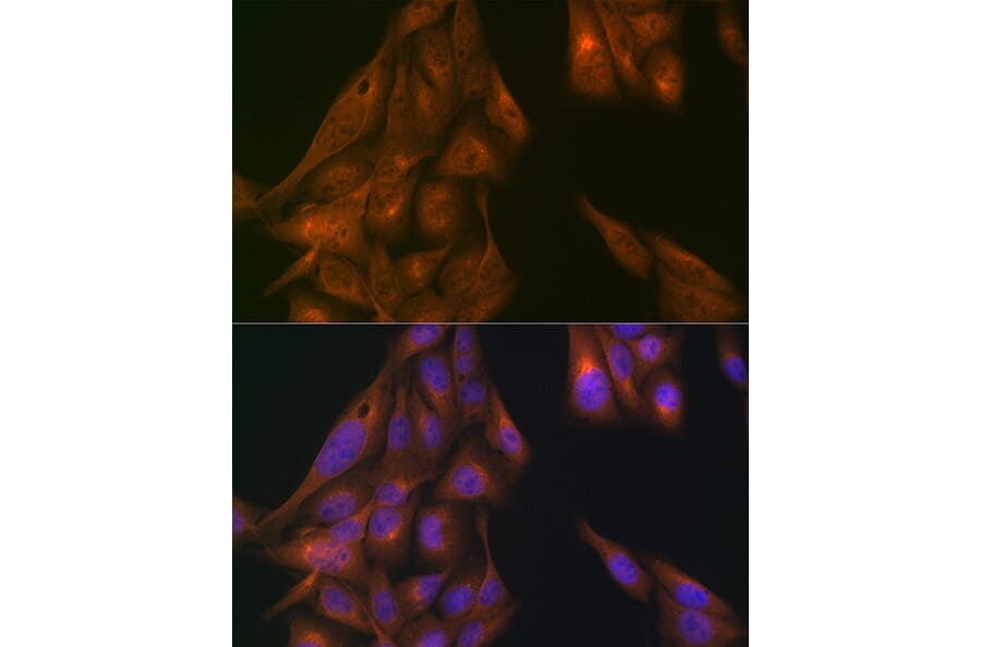 Immunofluorescence - Anti-USP11 Antibody (A308222) - Antibodies.com