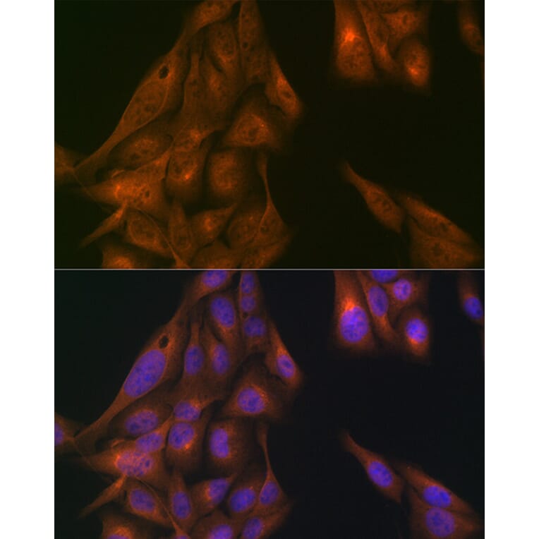 Immunofluorescence - Anti-USP11 Antibody (A308222) - Antibodies.com