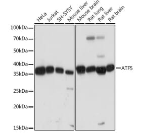 Western Blot - Anti-ATF5 Antibody [ARC2043] (A308224) - Antibodies.com