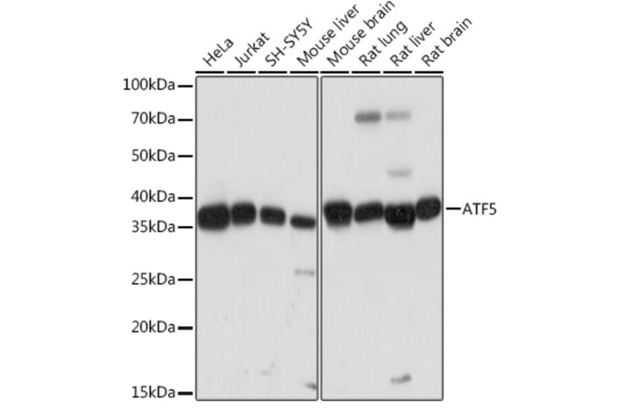 Western Blot - Anti-ATF5 Antibody [ARC2043] (A308224) - Antibodies.com