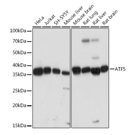 Western Blot - Anti-ATF5 Antibody [ARC2043] (A308224) - Antibodies.com