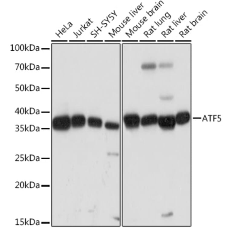 Western Blot - Anti-ATF5 Antibody [ARC2043] (A308224) - Antibodies.com