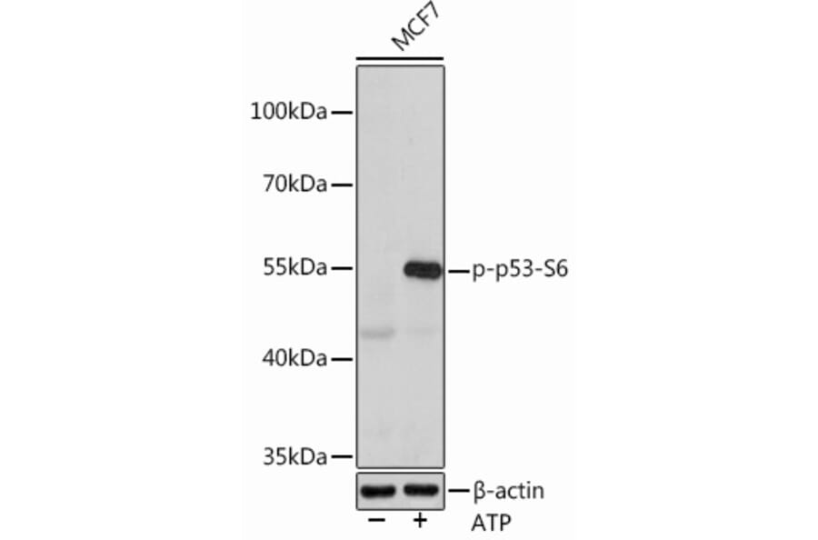 Western Blot - Anti-p53 (phospho Ser6) Antibody (A308225) - Antibodies.com